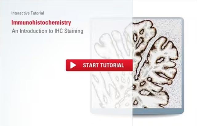 immunohistochemistry-an-overview-steps-to-better-ihc-staining-640x410