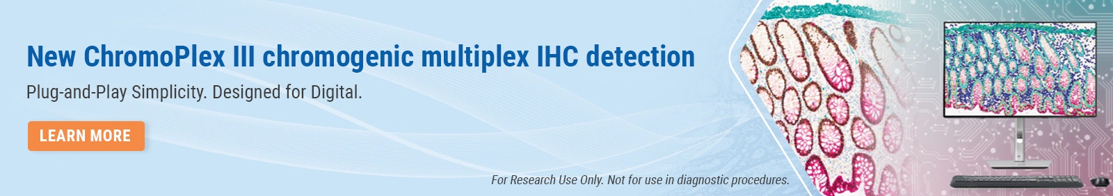New ChromoPlex III chromogenic multiplex IHC detection Plug-and-Play Simplicity. Designed for Digital.