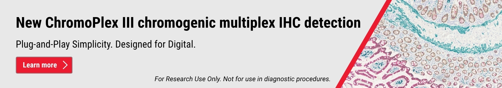New ChromoPlex III chromogenic multiplex IHC detection Plug-and-Play Simplicity. Designed for Digital.