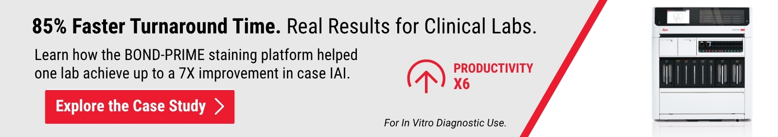 BOND-PRIME IHC/ISH Stainer – A Catalyst for Change