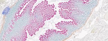 Multiplex Staining 4-Plex Multiplex Staining 4-Plex