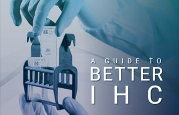 a-guide-to-better-ihc-640x410