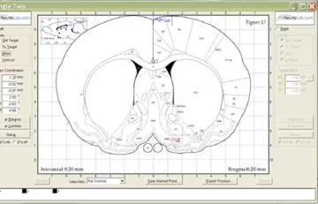 approach-angle-in-stereotaxic-surgery-640x410