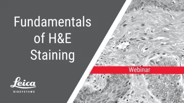 The Fundamentals of H&E Staining Webinar Thumbnail