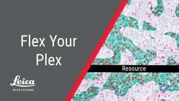 Flex Your Plex Thumbnail