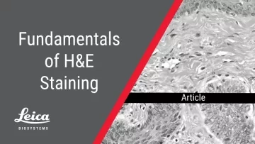 Fundamentals of H&E Staining Article Thumbnail