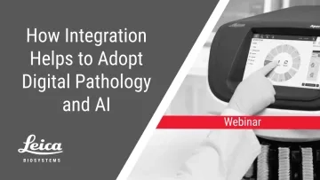 How Integration Helps Adopt Digital Pathology and AI Webinar Thumbnail