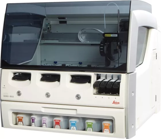 Leica BOND-MAX Fully Automated IHC and ISH Staining System