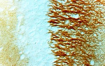 Campo CA 3 do hipocampo de ratos. Terminais de axônio positivo de sinaptofisina sobre células piramidais.