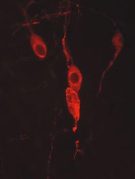Neurônios imunorreativos a neurofisina (ir) mostrados em secção transversal através do núcleo paraventricular do cérebro de um rato. (Fonte: Dr. Andreas Schober, Universidade of Heidelberg, Dept. de Neuroanatomia e IZN)