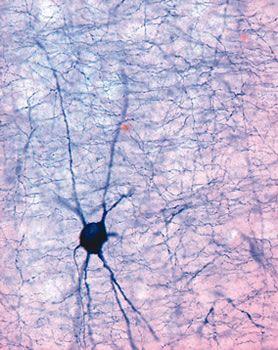 Transversal section through the rat brain cortex at the forebrain level. A large single neuron was labeled by NADPH-diaphorase histochemistry. The small axon and some branching dendrites are visible. (Source: Dr. Andreas Schober, University of Heidelberg