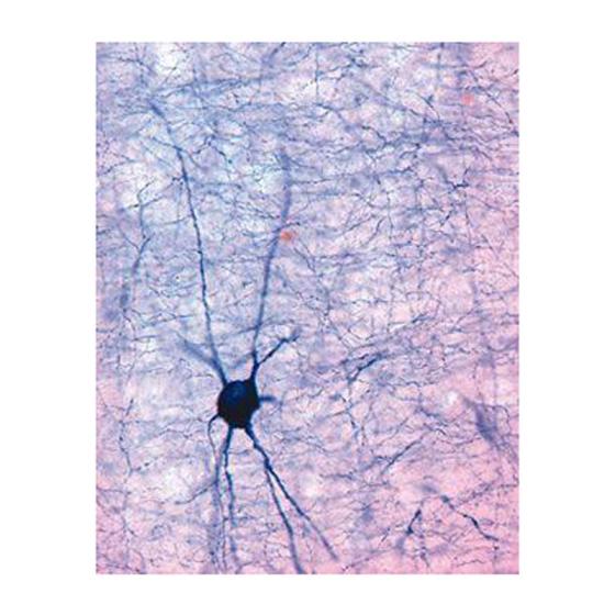 Coupe transversale à travers le cortex cérébral du rat au niveau du cerveau antérieur. Marquage histochimique d’un grand neurone à l’aide de la NADPH-diaphorase. Le petit axone et quelques dendrites ramifiées sont visibles. (Source : Dr Andreas