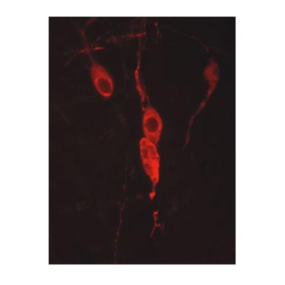Neurones à neurophysine immunoréactive (IR) révélés dans une coupe transversale à travers le noyau paraventriculaire du cerveau du rat. (Source : Dr Andreas Schober, Université de Heidelberg, Département de neuroanatomie et Centre interdisciplinai