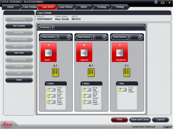 CEREBRO System für Probenverfolgung und Workflow-Management