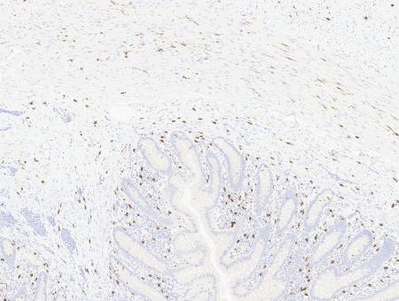 CD117 Appendix x 10 magnification CD117 Appendix x 10 magnification