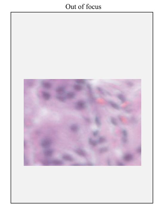 Aperio-iQC-Software_OutOfFocus2