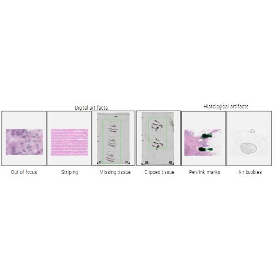 aperio-iqc-6-Artifact-image
