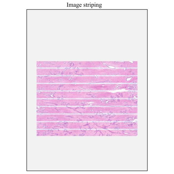 aperio-iqc-ImageStriping