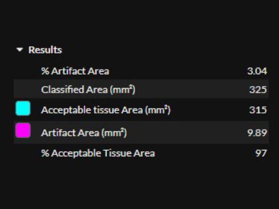 SlideQC quantitative results SlideQC quantitative results