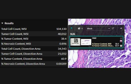 Step 4: Breast Macrodissect AI results