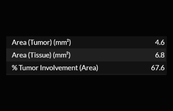 Tumor Burden – Area Metrics