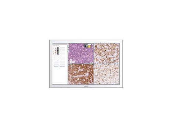 Aperio-WebViewer-DX-with-eSlide-Manager