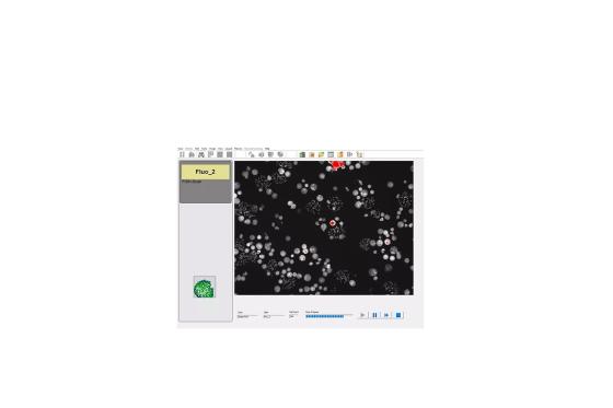 CytoVision-DX-FLMet-InterScan20x