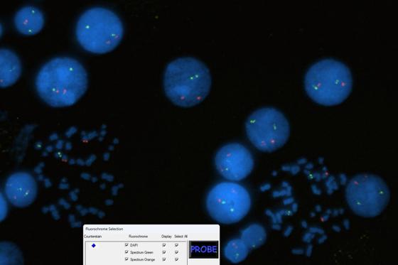 CytoVision-DX-InterMet-FISH1-hero