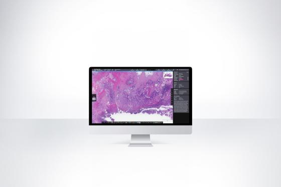 Aperio HALO AP - AI-powered, pathologist-centric image management system