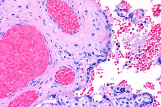 HistoCore SPECTRA H&E stains provide proven consistent diagnostic stain quality up to 1,600 slides.