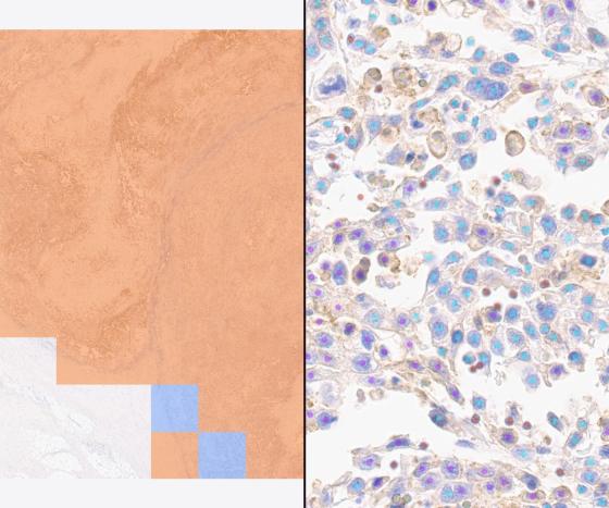 Lunit SCOPE PD-L1 22C3 Bladder (RUO)