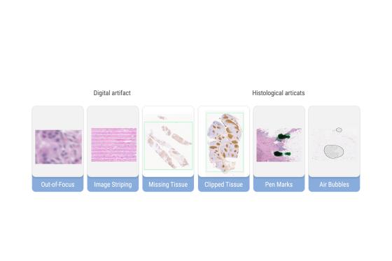 From Artifact to Accuracy – Quality Control Where You Need It