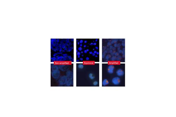 Images of sections stained using the Leica HER2 FISH System