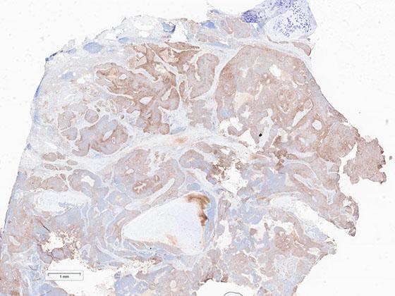 Lunit-SCOPE-PD-L1-CAL10-NSCLC-PDL-1-1x-Scanned-tissue-for-workflow