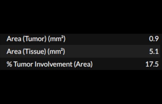 DeepDx Prostate ivd feature4
