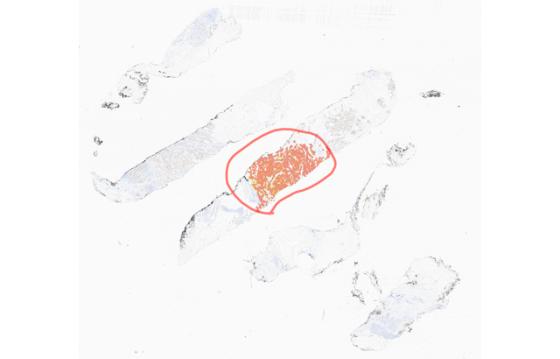 mindpeak_er_ruo_02_annotation_subregion_analysis