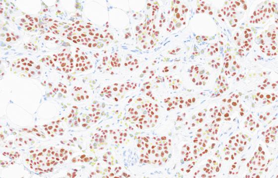mindpeak_er_ruo_04_cell_markup_threshold