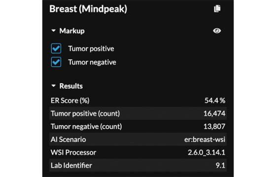 mindpeak_er_ruo_05_score_results_panel
