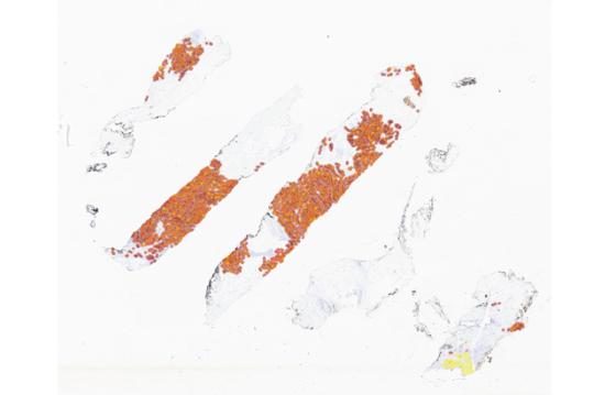 mindpeak_her2_ruo_01_whole_slide_cell_classification