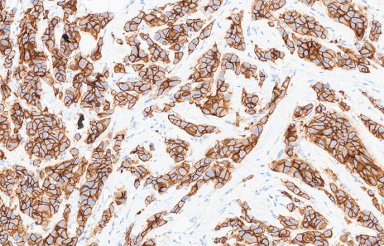 mindpeak_her2_ruo_03_ihc_field_unannotated