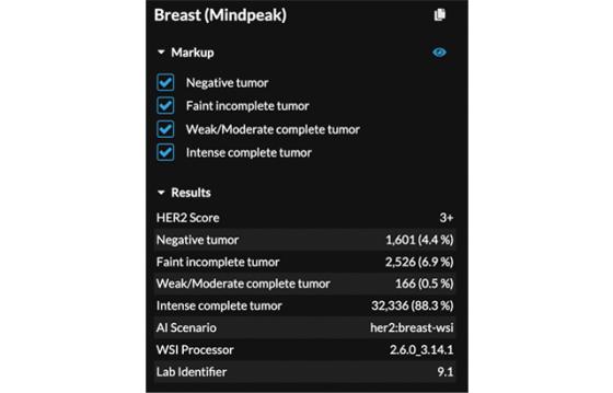 mindpeak_her2_ruo_05_score_results_panel