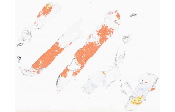 mindpeak_ki67_ruo_01_whole_slide_all_cells