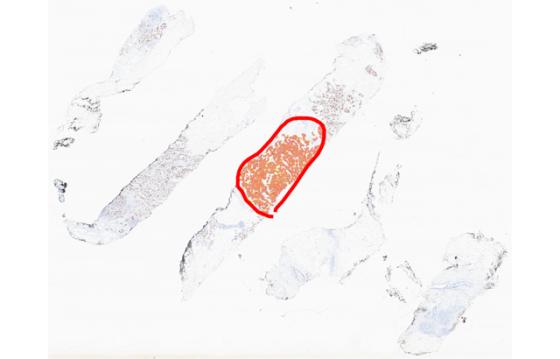 mindpeak_ki67_ruo_02_annotation_subregion_analysis