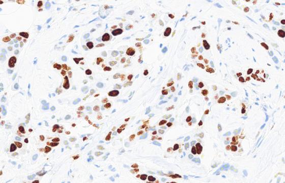 mindpeak_ki67_ruo_04_cell_markup