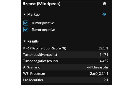 mindpeak_ki67_ruo_05_score_results_panel.jpg