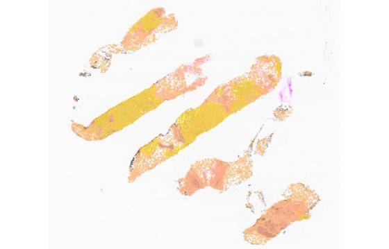 mindpeak_pantumor_he_ruo_01_whole_slide_segmentation.jpg