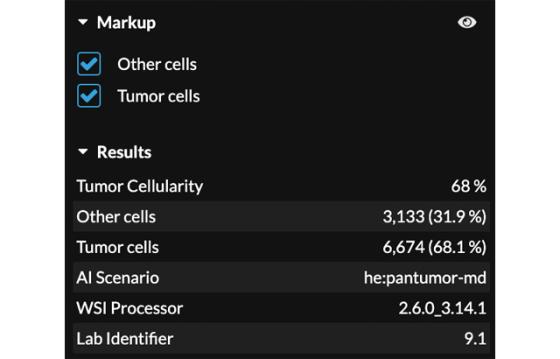 mindpeak_pantumor_he_ruo_05_cell_counts_cellularity_panel.jpg