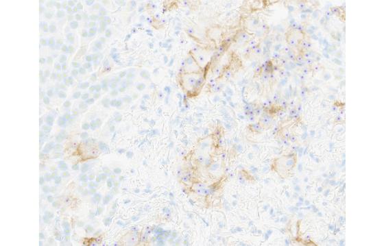 mindpeak_pantumor_pdl1_ruo_04_cell_markup