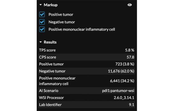 mindpeak_pantumor_pdl1_ruo_05_score_results_panel.jpg