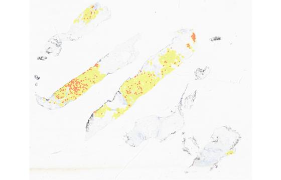 mindpeak_pr_ruo_01_whole_slide_cell_classification